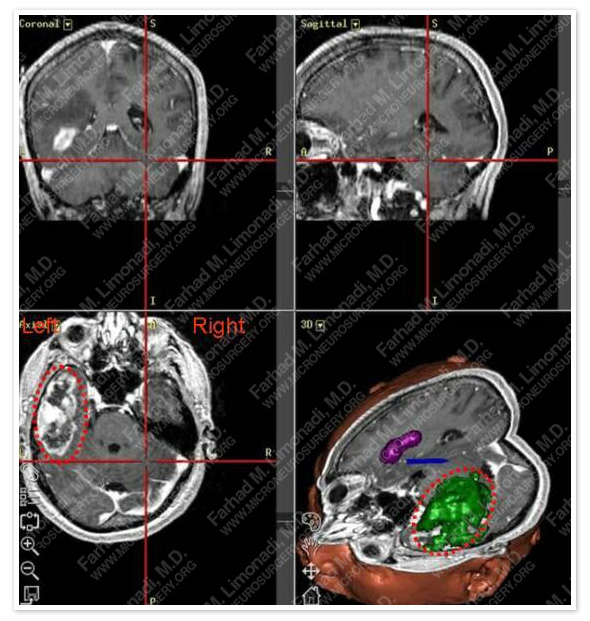 Case 2 Image 2