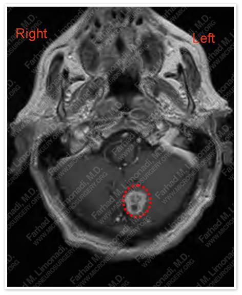 Case 1 Image 1