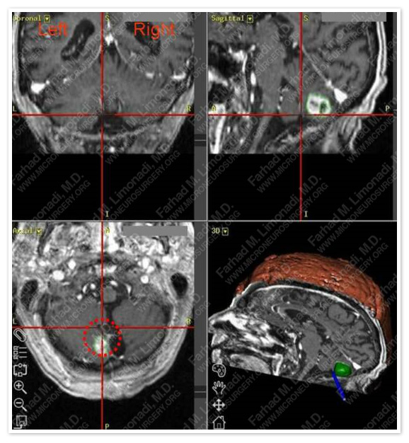 Case 1 Image 2