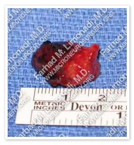 Case 1 Image 3