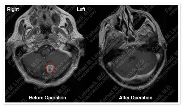 Case 1 Image 4