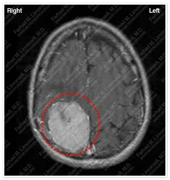 Case 1 Image 1