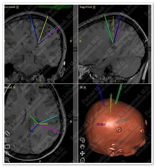 Case 1 Image 3