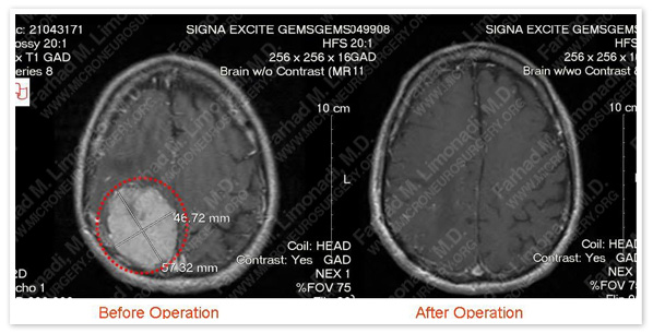Case 1 Image 4