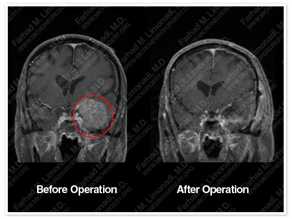Case 2 Image 5