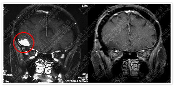 Case 8 Image 7