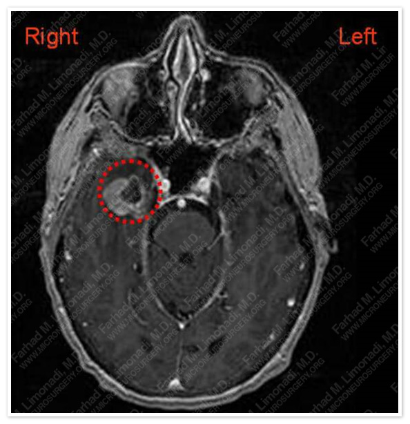 Case 1 Image 1