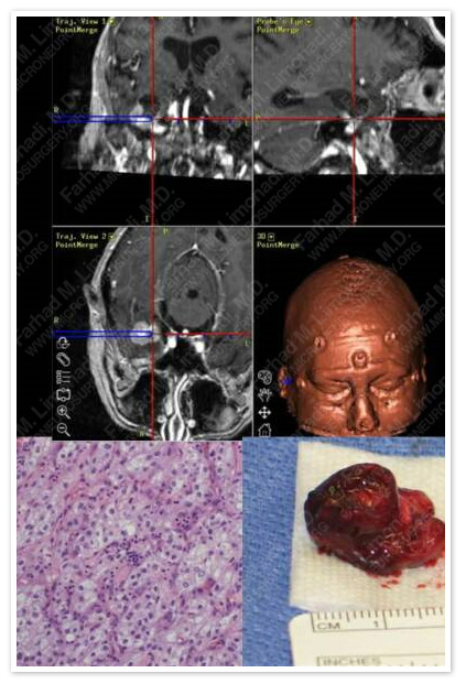 Case 1 Image 3