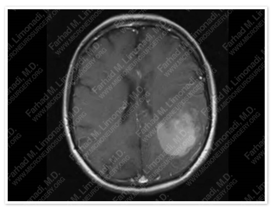 Case 2 Image 1