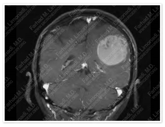 Case 2 Image 2