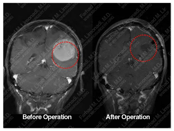 Case 2 Image 5