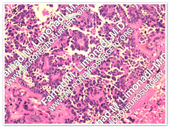 Case 2 Image 6