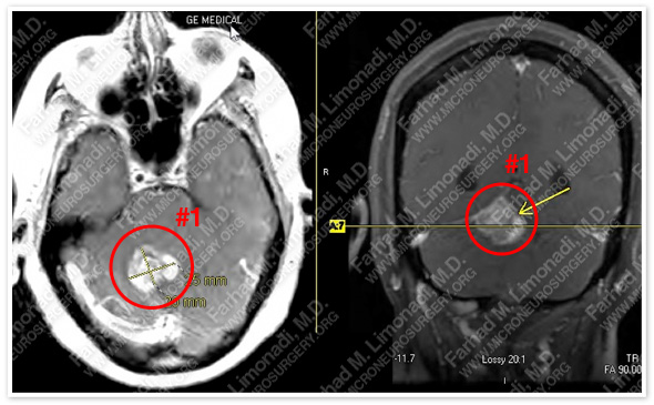 Case 3 Image 2