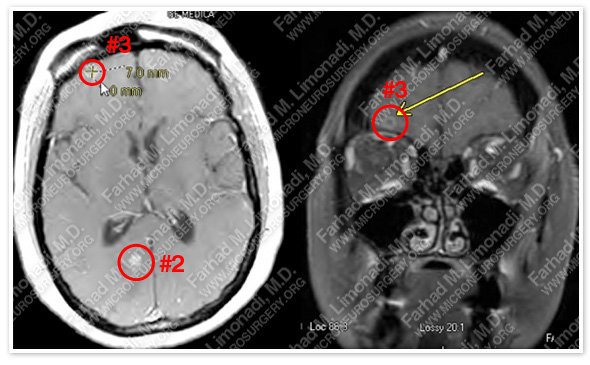 Case 3 Image 3