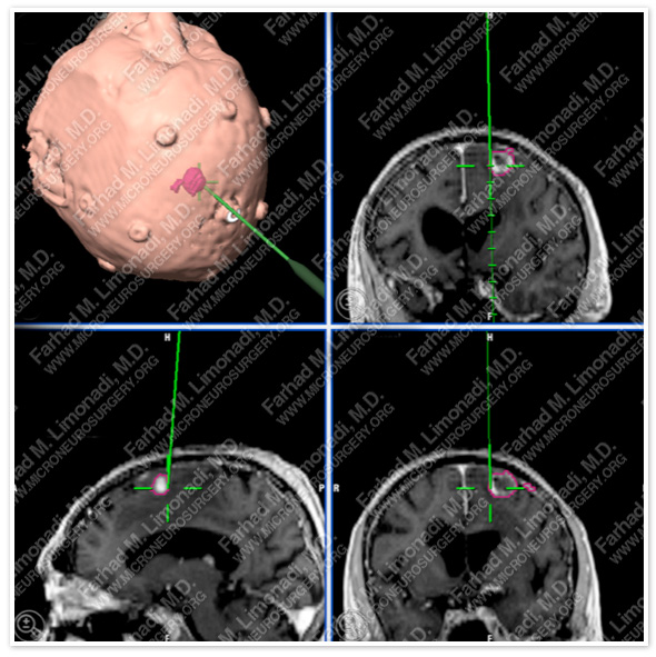 Case 4 Image 2