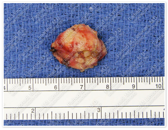 Case 4 Image 3