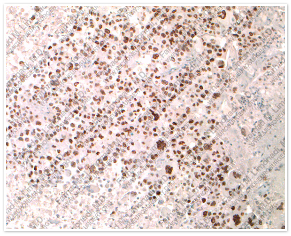Case 4 Image 5