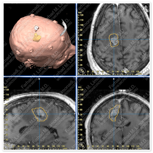 Case 5 Image 2