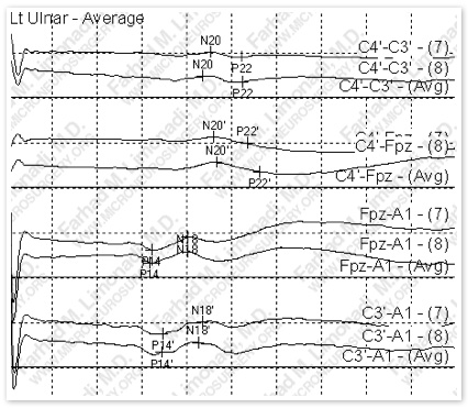 Case 5 Image 3