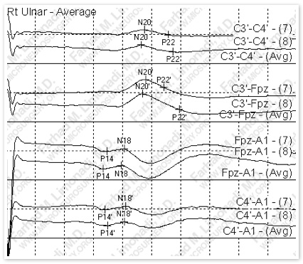 Case 5 Image 4