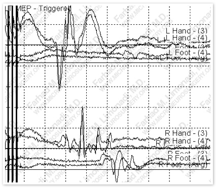 Case 5 Image 5