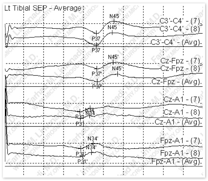 Case 5 Image 6