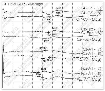 Case 5 Image 7