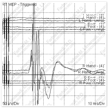Case 5 Image 8