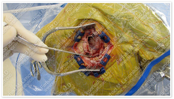 Case 5 Image 9