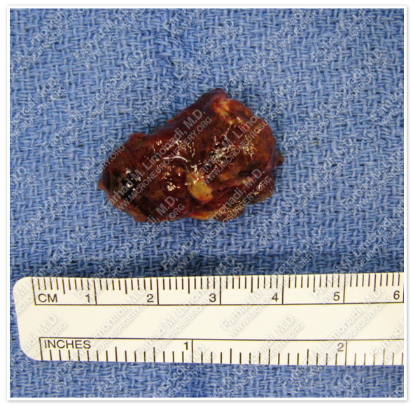 Case 5 Image 10