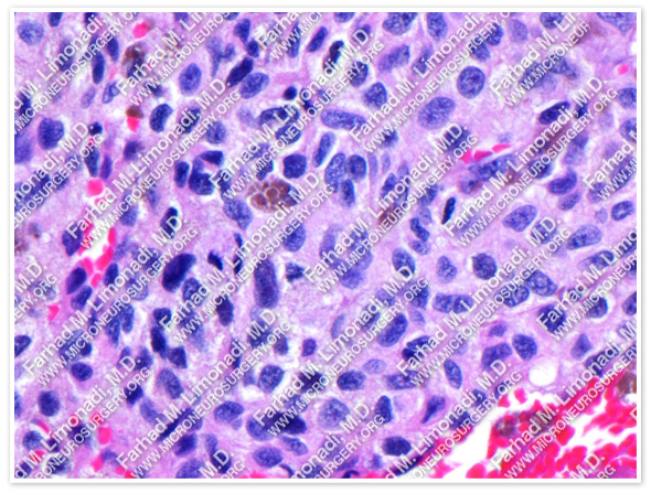 Case 5 Image 11