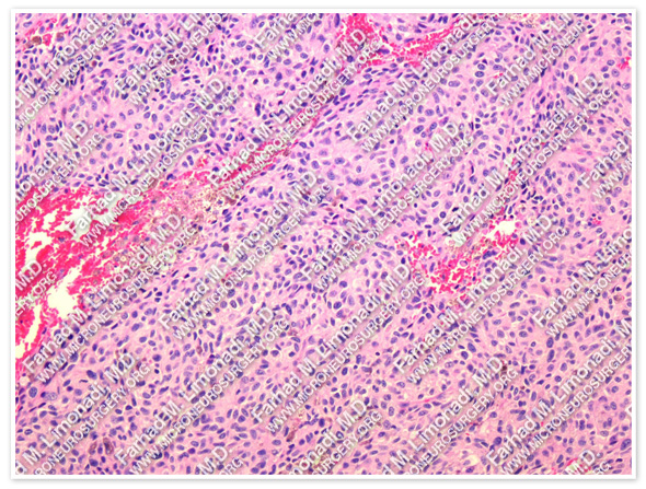 Case 5 Image 12