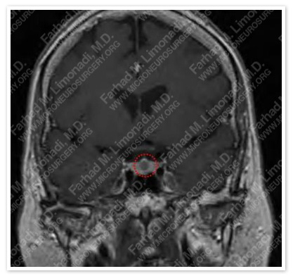 Case 1 Image 1