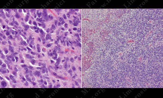 gbm-case12-008
