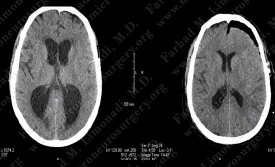 gbm case9 img14