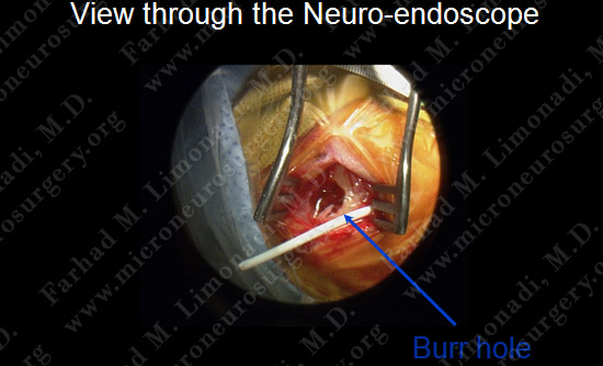 gbm case9 img16