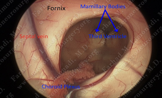 gbm case9 img18
