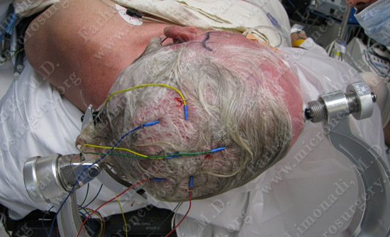 gbm case9 img2