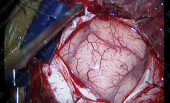gbm case9 img7