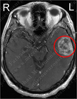 Case 3 Image 1