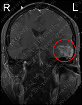 Case 3 Image 2