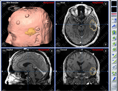Case 3 Image 3