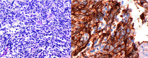 Case 3 Image 4