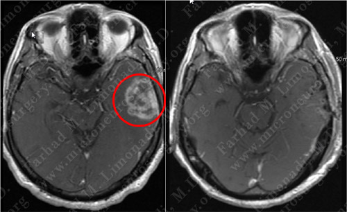 Case 3 Image 5