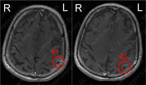 Case 4 Image 1