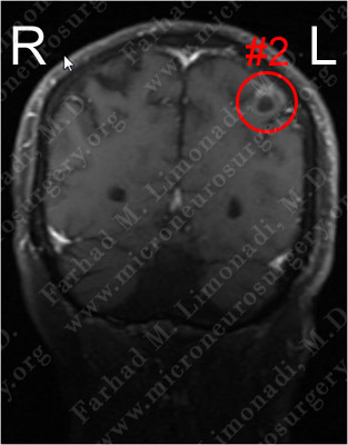 Case 4 Image 2