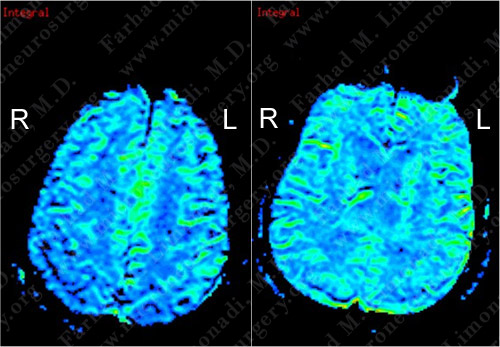 Case 4 Image 3