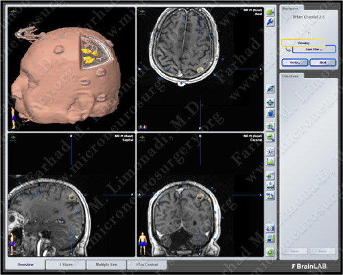 Case 4 Image 4