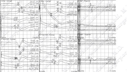 Case 4 Image 5