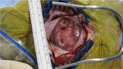 Case 4 Image 6
